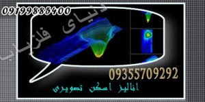 آنالیز اسکن فلزیاب تصویری